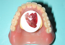 ゴシックアーチ