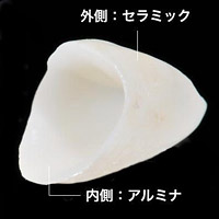 オールセラミック