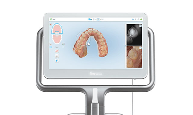 シミュレーション