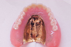 ブレードティース