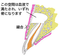 この空間は血液で満たされ、いずれ骨になります
