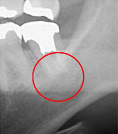 マイクロスコープ